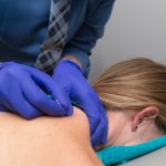 Dry Needling