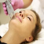 Pigmentation removal using laser