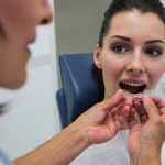 Why More Londoners Are Choosing Invisalign Over Traditional Braces