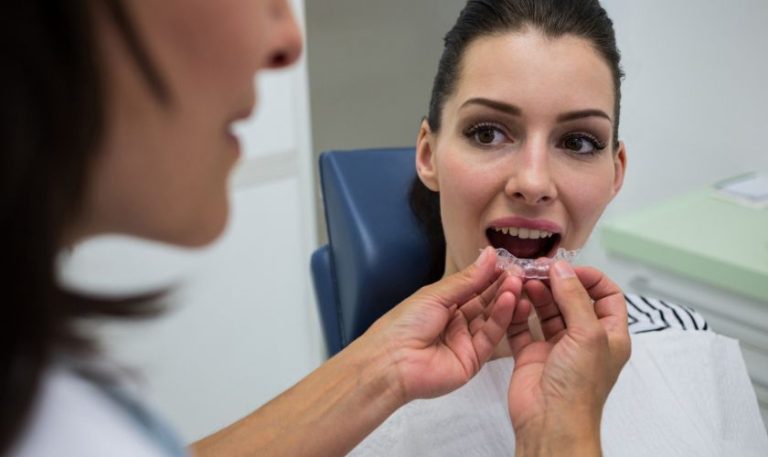 Why More Londoners Are Choosing Invisalign Over Traditional Braces